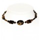 Tiger Eye Choker and Earring Set